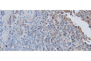 Immunohistochemistry of paraffin-embedded Rat spleen using CCL7 Polyclonal Antibody at dilution of 1:50 (CCL7 anticorps)