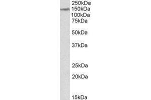 AP22387PU-N LMTK2 antibody staining of Human Cerebellum lysate at 2 µg/ml (35µg protein in RIPA buffer). (LMTK2 anticorps  (Internal Region))