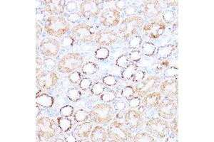 Immunohistochemistry of paraffin-embedded mouse kidney using  antibody (ABIN6131164, ABIN6136413, ABIN6136415 and ABIN6217209) at dilution of 1:100 (40x lens).
