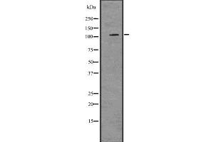 Western blot analysis of PRKD2 using LOVO whole  lysates.