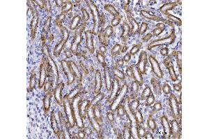 IHC analysis of OAT2/SLC22A7 using anti-OAT2/SLC22A7 antibody (ABIN7601355).