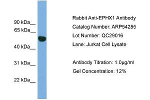 WB Suggested Anti-EPHX1  Antibody Titration: 0. (EPHX1 anticorps  (N-Term))