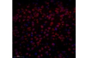 Immunofluorescence of paraffin embedded mouse prefrontal lobe using GPR137A (ABIN7073996) at dilution of 1: 650 (300x lens) (GPR137 anticorps)