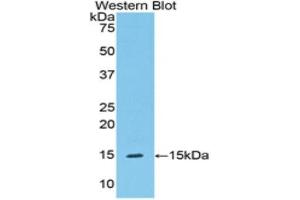 Western Blotting (WB) image for anti-Serpin Peptidase Inhibitor, Clade G (C1 Inhibitor), Member 1 (SERPING1) (AA 211-331) antibody (ABIN3208987) (SERPING1 anticorps  (AA 211-331))