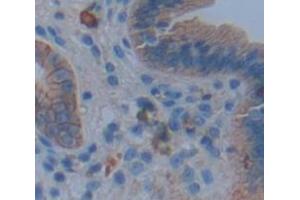 IHC-P analysis of Human Tissue, with DAB staining. (IL17RA anticorps  (AA 33-172))