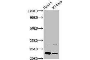 Western Blot Positive WB detected in: Rat heart tisue, Rat kidney tissue All lanes: PTPMT1 antibody at 3 μg/mL Secondary Goat polyclonal to rabbit IgG at 1/50000 dilution Predicted band size: 23, 16, 17 kDa Observed band size: 23 kDa (PTPMT1 anticorps  (AA 28-201))