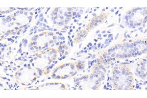 Detection of TNC in Human Stomach Tissue using Polyclonal Antibody to Tenascin C (TNC) (TNC anticorps  (AA 49-181))