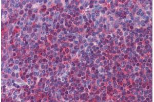 Human Tonsil: Formalin-Fixed, Paraffin-Embedded (FFPE)