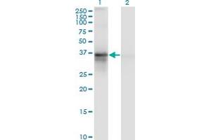 Western Blot analysis of RP2 expression in transfected 293T cell line by RP2 monoclonal antibody (M02), clone 5C10. (RP2 anticorps  (AA 251-350))
