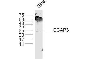 Siha lysates probed with GCAP3 Polyclonal Antibody, Unconjugated  at 1:300 dilution and 4˚C overnight incubation.