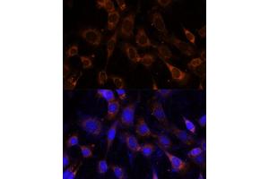 Immunofluorescence analysis of NIH-3T3 cells using VPS25 Polyclonal Antibody (ABIN6128913, ABIN6150122, ABIN6150123 and ABIN6217011) at dilution of 1:100 (40x lens). (VPS25 anticorps  (AA 1-176))