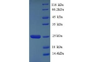 SDS-PAGE (SDS) image for Major Histocompatibility Complex, Class II, DQ alpha 2 (HLA-DQA2) (AA 24-214) protein (His tag) (ABIN5712944)