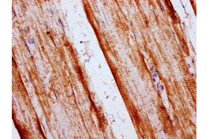 IHC image of ABIN7170591 diluted at 1:400 and staining in paraffin-embedded human skeletal muscle tissue performed on a Leica BondTM system. (FAM33A anticorps  (AA 1-121))