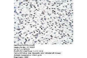 Rabbit Anti-SURF6 Antibody  Paraffin Embedded Tissue: Human Heart Cellular Data: Myocardial cells Antibody Concentration: 4. (SURF6 anticorps  (Middle Region))