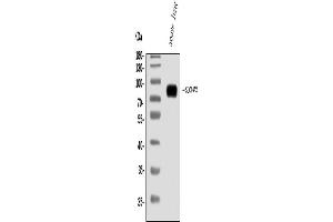 Western blot analysis of SLC44A2 using anti-SLC44A2 antibody (ABIN7599530).
