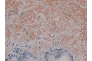 Detection of PKIb in Human Prostate Tissue using Polyclonal Antibody to Protein Kinase Inhibitor Beta (PKIb)