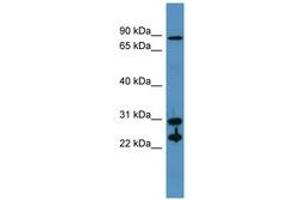 Image no. 1 for anti-Carbonic Anhydrase II (CA2) (AA 73-122) antibody (ABIN6746752) (CA2 anticorps  (AA 73-122))