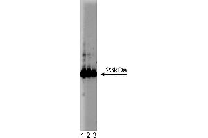 Western Blotting (WB) image for anti-Glutathione S-Transferase pi 1 (GSTP1) (AA 5-210) antibody (ABIN968135)