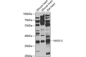 Western blot analysis of extracts of various cell lines, using NKX2-5 antibody (ABIN6132412, ABIN6144644, ABIN6144646 and ABIN6221293) at 1:1000 dilution. (NK2 Homeobox 5 anticorps  (AA 1-135))