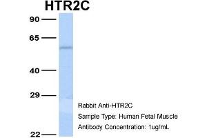 Host:  Rabbit  Target Name:  HTR2C  Sample Type:  Human Fetal Muscle  Antibody Dilution:  1.