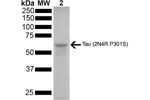 SDS-PAGE of ~67 kDa Human Tau Protein 2N4R P301S Monomer (ABIN6929391, ABIN6929392 and ABIN6929393).