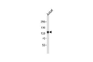 MER Antibody (ABIN392343 and ABIN2841983) western blot analysis in Jurkat cell line lysates (35 μg/lane). (MERTK anticorps)