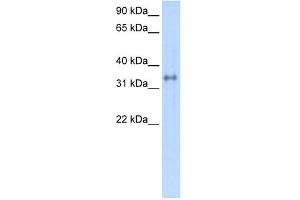 Carbonic Anhydrase IV antibody used at 1 ug/ml to detect target protein. (CA4 anticorps  (C-Term))