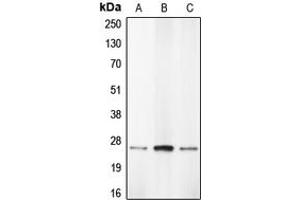 Western blot analysis of Caspase 1 expression in THP1 (A), HL60 (B), BAEC (C) whole cell lysates. (Caspase 1 anticorps  (Center))