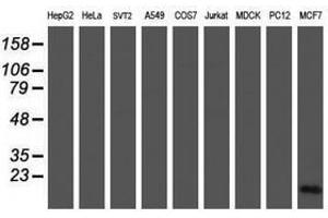 Image no. 2 for anti-Cellular Retinoic Acid Binding Protein 2 (CRABP2) antibody (ABIN1497621) (CRABP2 anticorps)