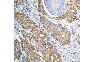 IHC analysis of DARS2 using anti-DARS2 antibody (ABIN6719279). (DARS2 anticorps  (AA 334-448))