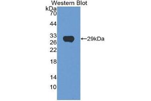 Western Blotting (WB) image for anti-Hexosaminidase A (HEXA) (AA 318-529) antibody (ABIN1862597)