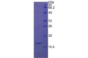 SDS-PAGE of Protein Standard from the Kit  (Highly purified E. (TGFB1 Kit ELISA)