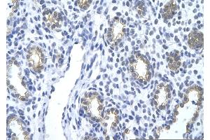 Rabbit Anti-KRT18 Antibody       Paraffin Embedded Tissue:  Human alveolar cell   Cellular Data:  Epithelial cells of renal tubule  Antibody Concentration:   4.