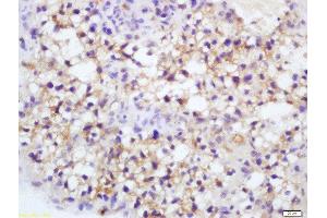 Formalin-fixed and paraffin embedded mouse placenta labeled with Rabbit Anti-Endothelial Lipase Polyclonal Antibody, Unconjugated  at 1:200 followed by conjugation to the secondary antibody and DAB staining (LIPG anticorps  (AA 1-500))