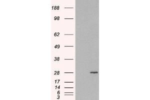 HEK293 overexpressing RAB11A(ABIN5362200) and probed with ABIN184807 (mock transfection in first lane). (RAB11A anticorps  (C-Term))