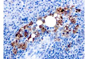 Formalin-fixed, paraffin-embedded human Spleen stained with TRAcP Mouse Recombinant Monoclonal Antibody (rACP5/1070).