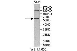 Western Blotting (WB) image for anti-Makorin Ring Finger Protein 3 (MKRN3) antibody (ABIN1855943) (MKRN3 anticorps)