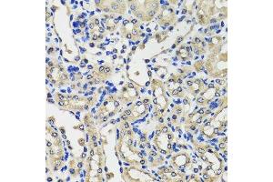 Immunohistochemistry of paraffin-embedded mouse kidney using SCG3 antibody. (SCG3 anticorps  (AA 199-468))