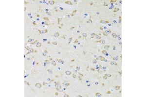 Immunohistochemistry of paraffin-embedded rat brain using YWHAZ antibody.