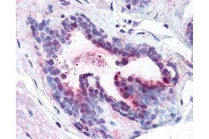 affinity purified anti-Pdcd4 pS457 antibody was used at 1.