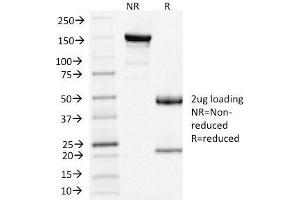 SDS-PAGE Analysis of Purified Clathrin, LC Mouse Monoclonal Antibody (CLC/1421). (CLTA/CLTB anticorps  (N-Term))