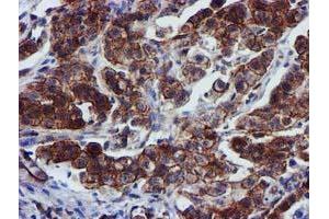 Image no. 6 for anti-Epsin 2 (EPN2) antibody (ABIN1498050)