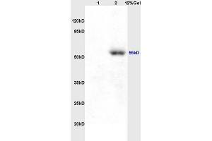 Lane 1: rat brain lysates Lane 2: human colon carcinoma lysates probed with Anti AVPR2 Polyclonal Antibody, Unconjugated (ABIN731468) at 1:200 in 4 °C.