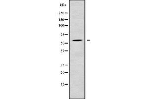 Western blot analysis of RPS6KL1 using LOVO whole cell lysates (RPS6KL1 anticorps  (Internal Region))