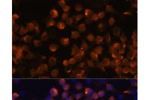 Immunofluorescence analysis of Raw264. (Complement Factor B anticorps)