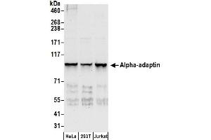 anti-Adaptor-Related Protein Complex 2, alpha 1 Subunit (AP2A1) (AA 600-650) antibody