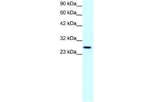 Human Jurkat; WB Suggested Anti-CLDN13 Antibody Titration: 1. (Claudin 13 (CLDN13) (C-Term) anticorps)