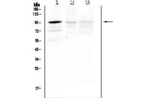 Western blot analysis of HECTD3 using anti-HECTD3 antibody (ABIN6719595).