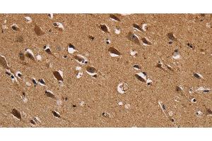 Immunohistochemistry of paraffin-embedded Human brain using NDUFS1 Polyclonal Antibody at dilution of 1:50