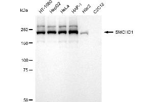 Western blotting analysis using SMCHD1 antibody (ABIN7800450). (Recombinant SMCHD1 anticorps)